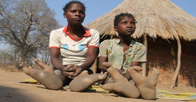 Khám Phá Bộ Lạc Vadoma: Những Người Có Đôi Chân Kỳ Lạ Ở Zimbabwe