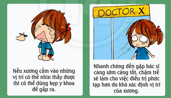 Khi bị hóc, cần nhanh chóng đến bác sĩ để gắp xương ra Cách xử lý hiệu quả khi bị hóc xương cá
