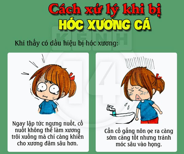 Khi thấy dấu hiệu bị hóc xương thì lập tức ngừng nuốt Cách xử lý hiệu quả khi bị hóc xương cá