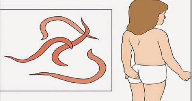 Bắt giun kim cho trẻ tại nhà: hướng dẫn an toàn, mẹo và cảnh báo